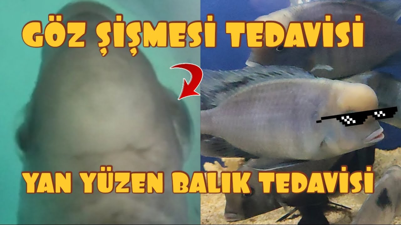 Göz Şişmesi ve Yan Yatma Tedavisi