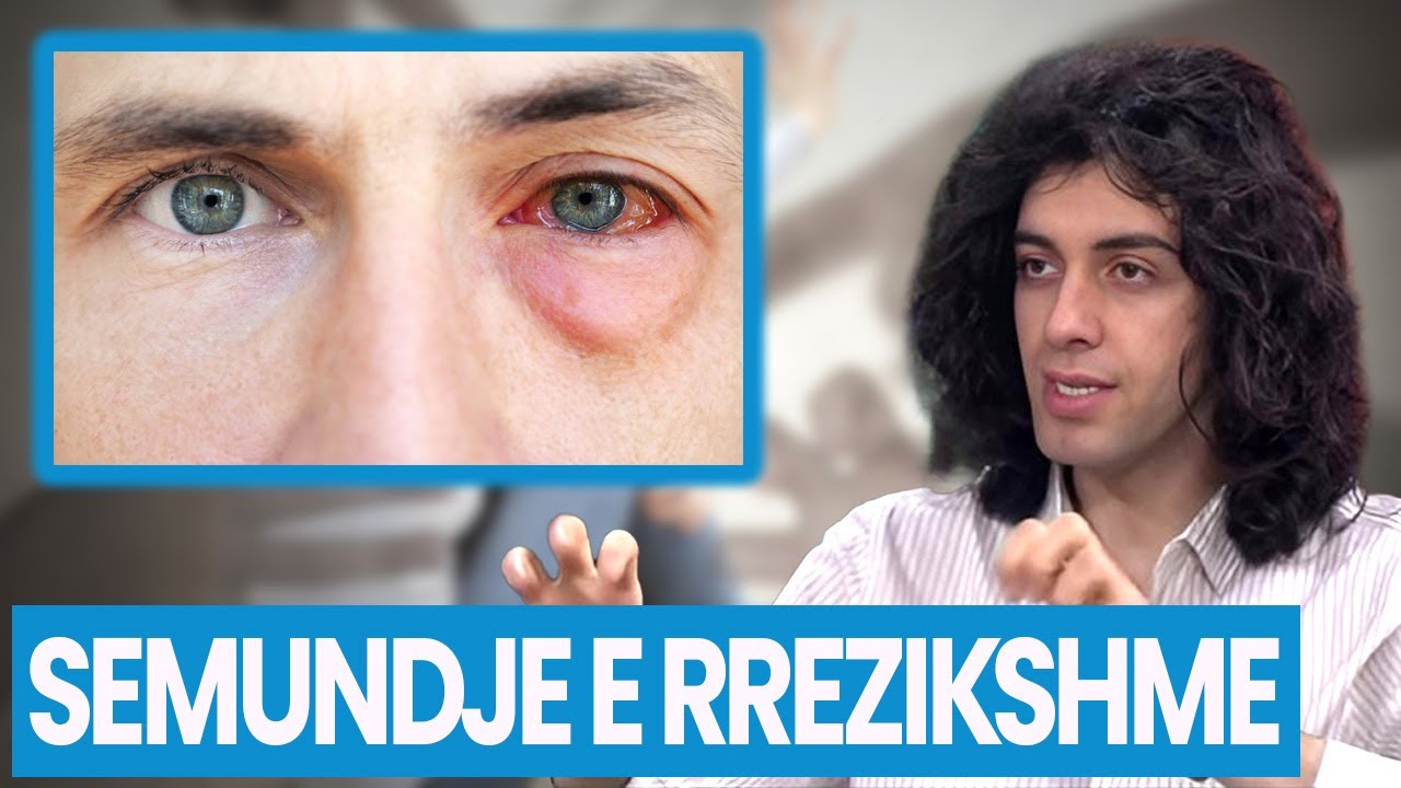 Trupi po ULËRIN për NDIHMË! Enjtja e syve, PROBLEMET e RREZIKSHME që trupi po ju tregon