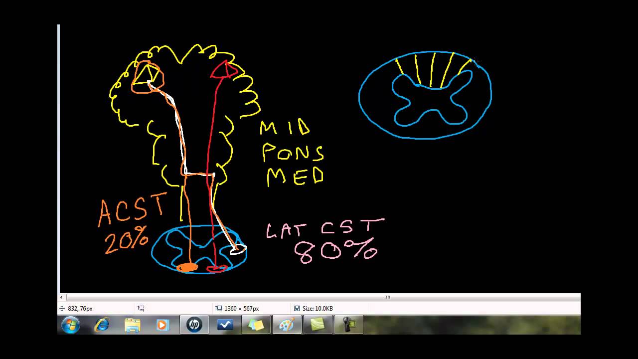Cervical Cord Compression: Understanding the Laminated Cervical Spinal Cord