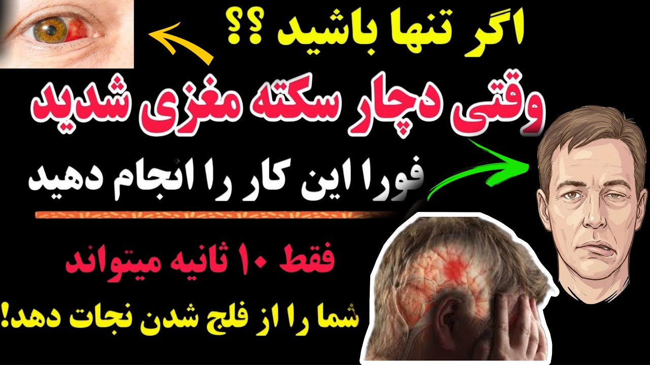 سکته مغزی: چگونه مغز خود را در عرض ۴ ساعت نجات دهید (این کار را انجام دهید)