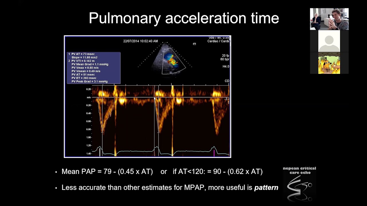 Pulmonary Haemodynamics