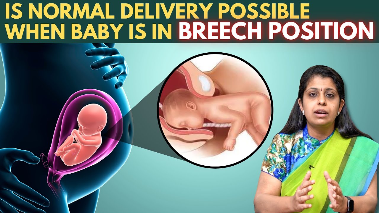 What Happens If The Baby Is In Breech Position - சுகப்பிரசவம் சாத்தியமா | Dr Deepthi Jammi