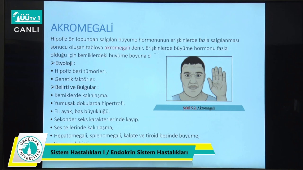 SHYMO Uzaktan Eğitim Dersleri - Sistem Hastalıkları -  Endokrin Sistem Hastalıkları