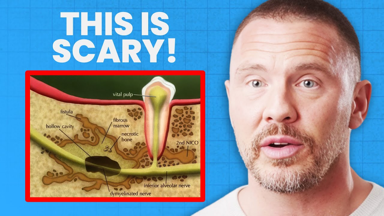 If You’ve Had Your Wisdom Teeth Removed, You Need to Watch This! | Dr. Dominik Nischwitz