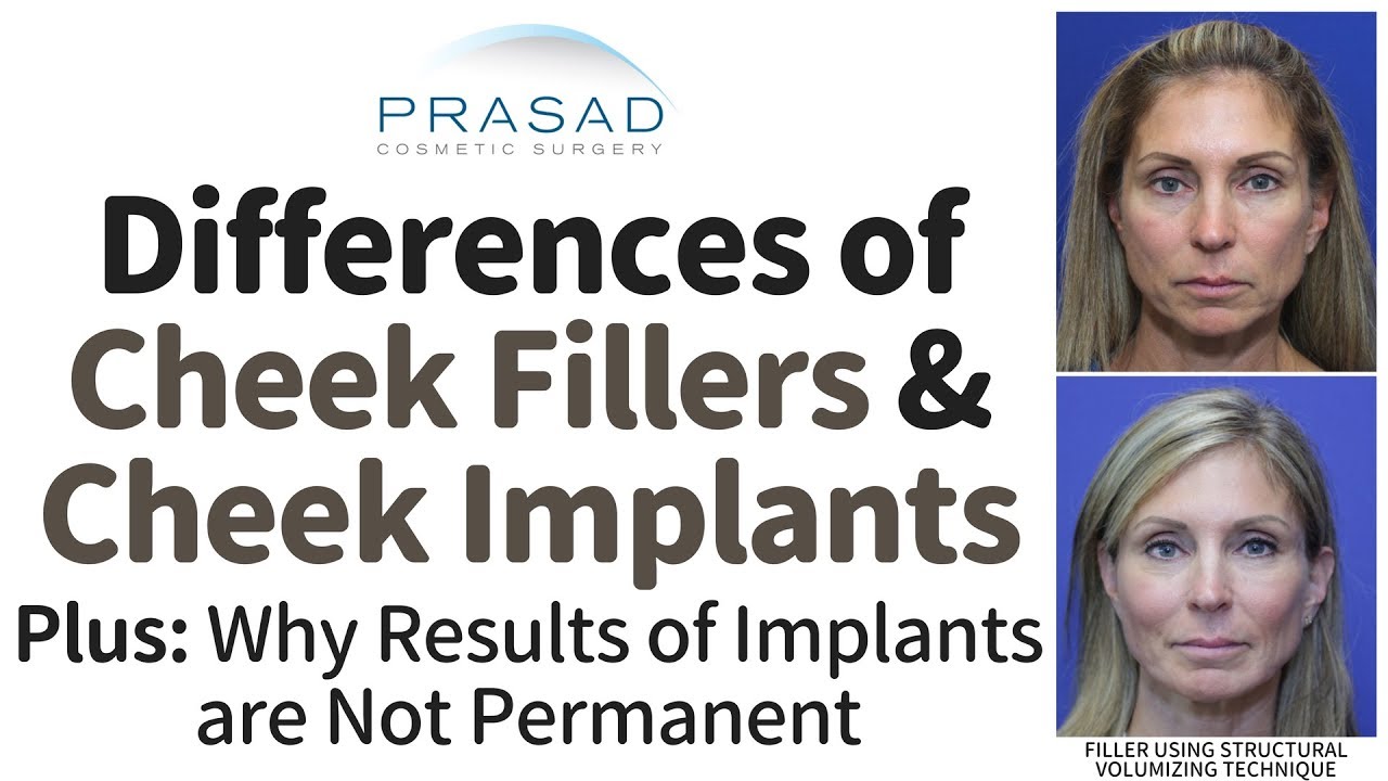 How Cheek Fillers and Cheek Implants Differ with Recovery, Precise Customization, and Longevity