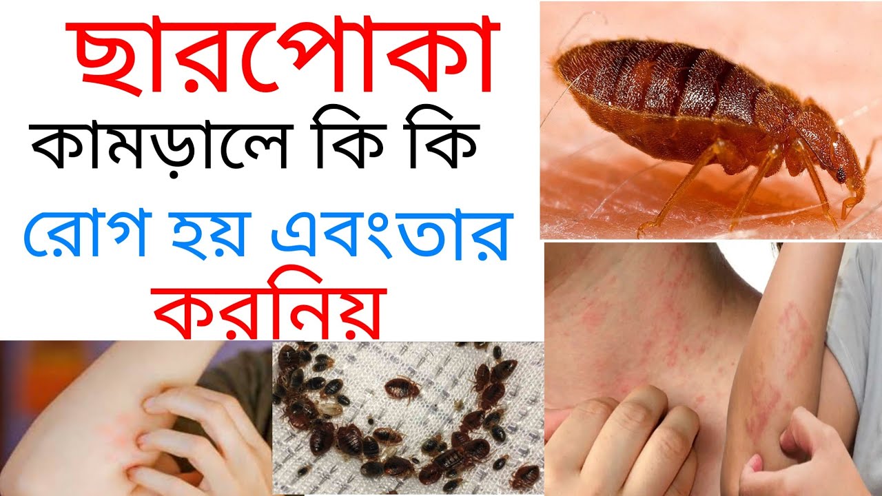 ছারপোকা কামড়ালে কি কি রোগ হয় এবং তার করনিয়