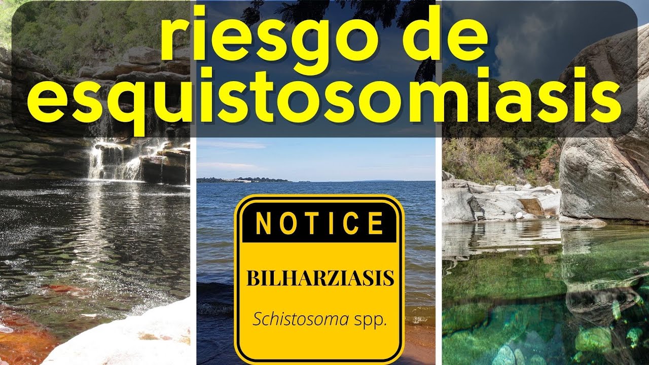 Schistosomiasis (Esquistosomiasis) - Una parasitosis negligenciada y con poca visibilidad