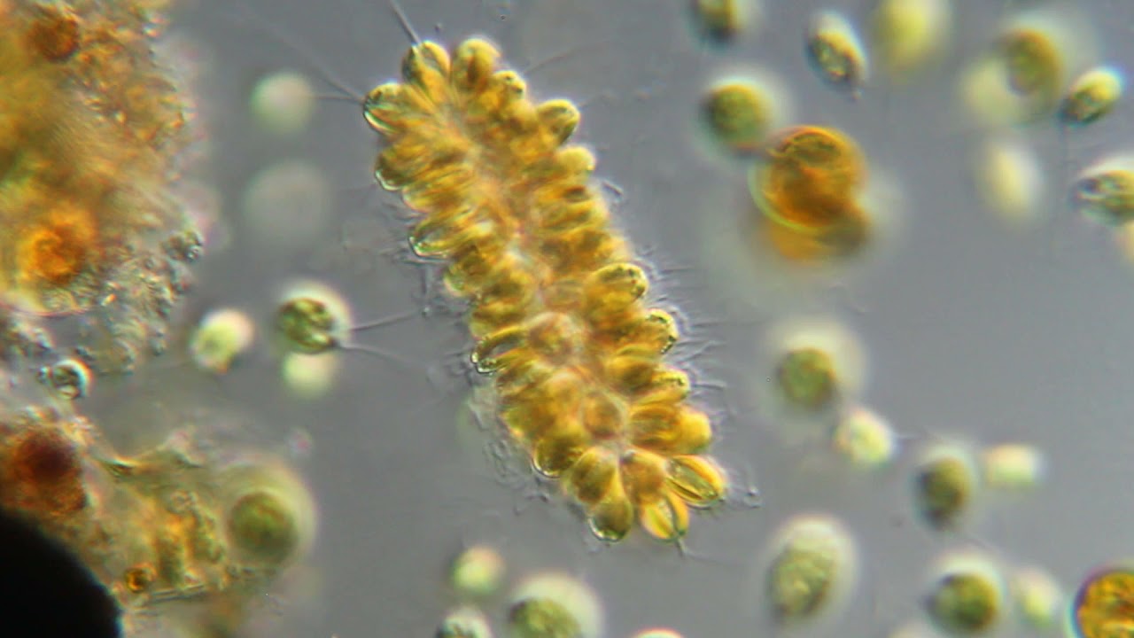 Synura, a colonial flagellated alga