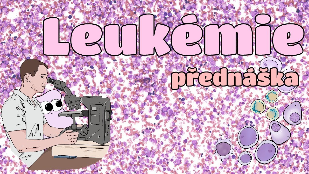 Patologie - Leuk&eacute;mie, myeloproliferace (CZ)