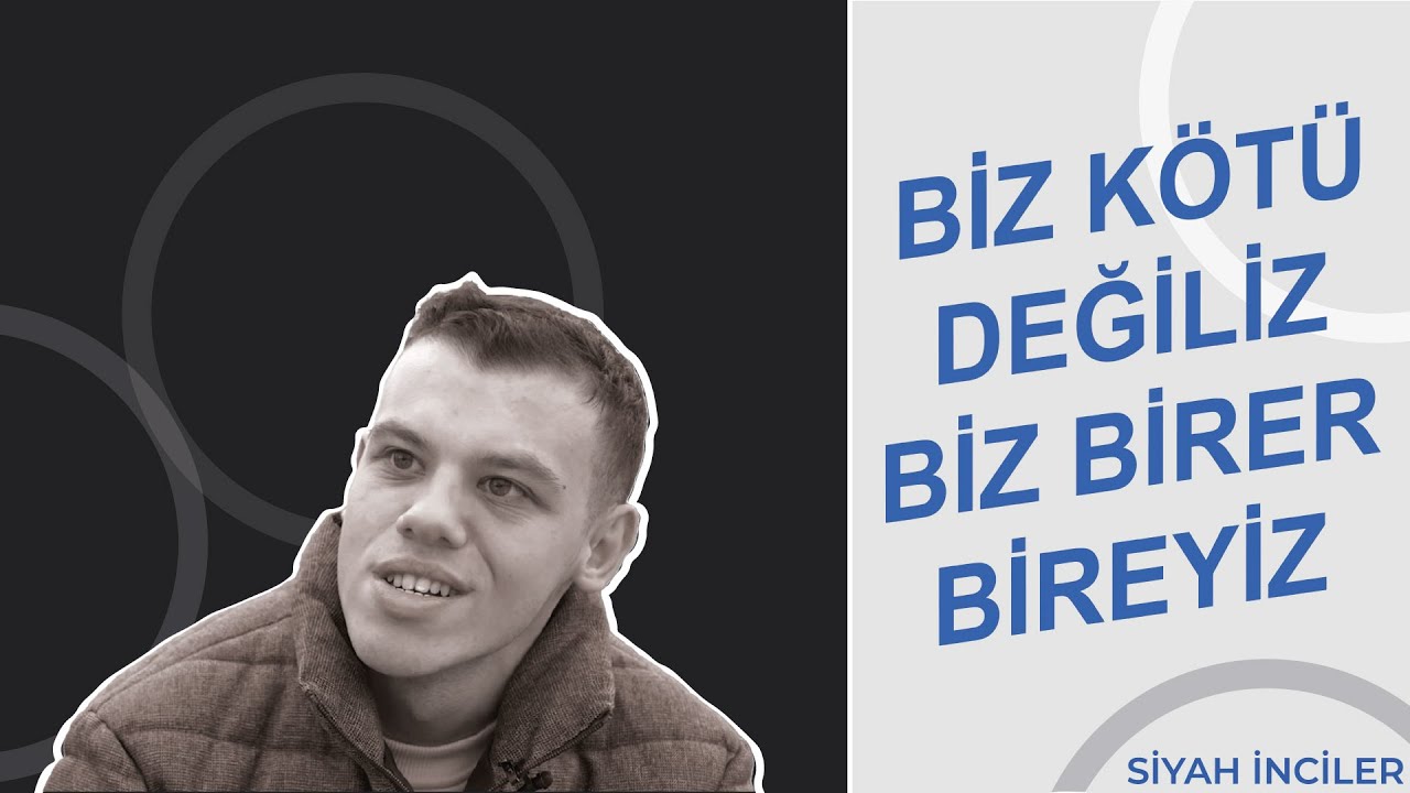 Williams Sendromlu Doğdum Diye Hiç İsyan Etmedim. | Siyah İnciler - Duha