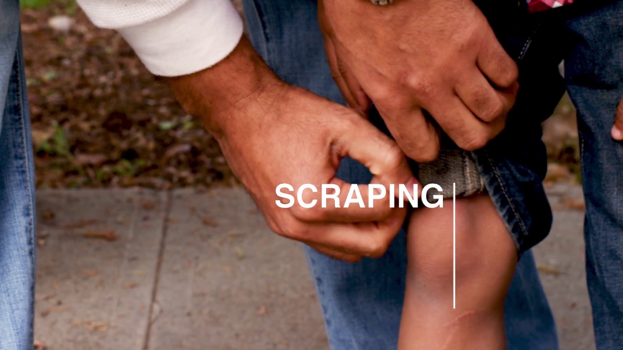 Bio-Oil: For your everyday scars