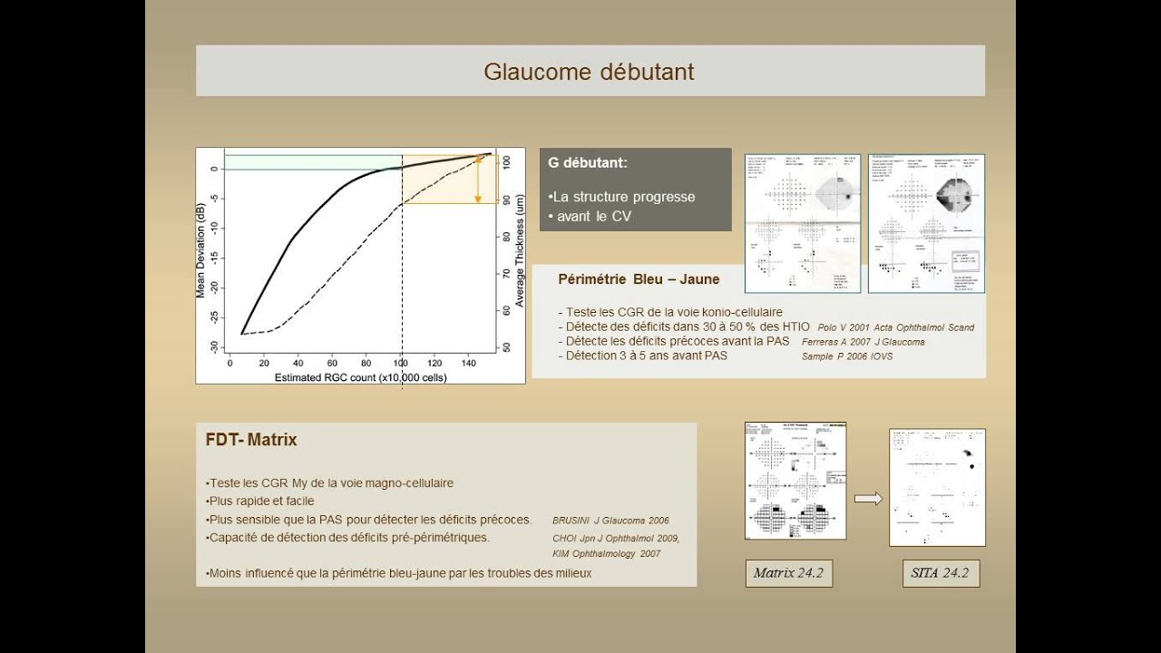 Surveillance du glaucome : Champ Visuel. May F.