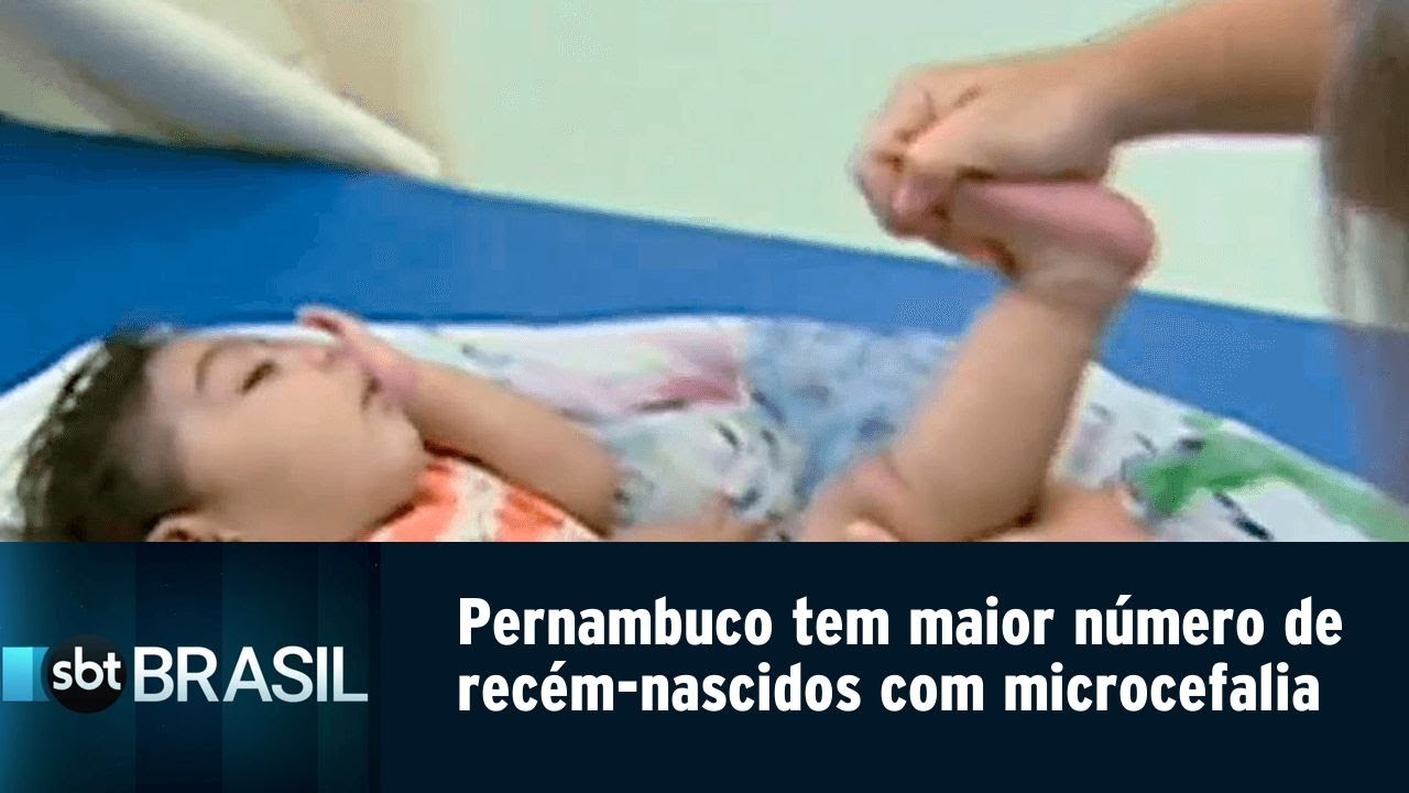 Pernambuco tem maior número de nascidos com microcefalia após surto de Zica | SBT Brasil (07/02/19)