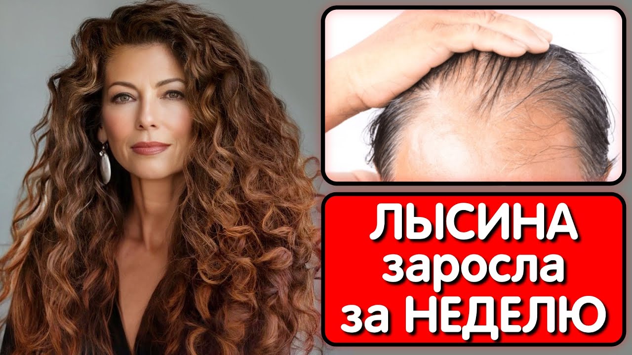 Индийский секрет густых волос ! ВОЛОСЫ РАСТУТ БЫСТРЕЕ  даже на ЗАЛЫСИНАХ и НЕ ВЫПАДАЮТ !