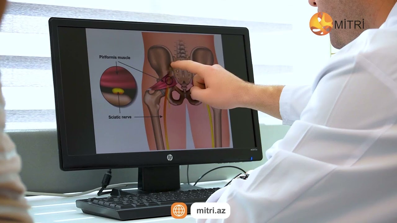 Çanaq və onurğa sütunu xəstəliklərinin, qamət problemlərinin müalicəsi | MİTRİ