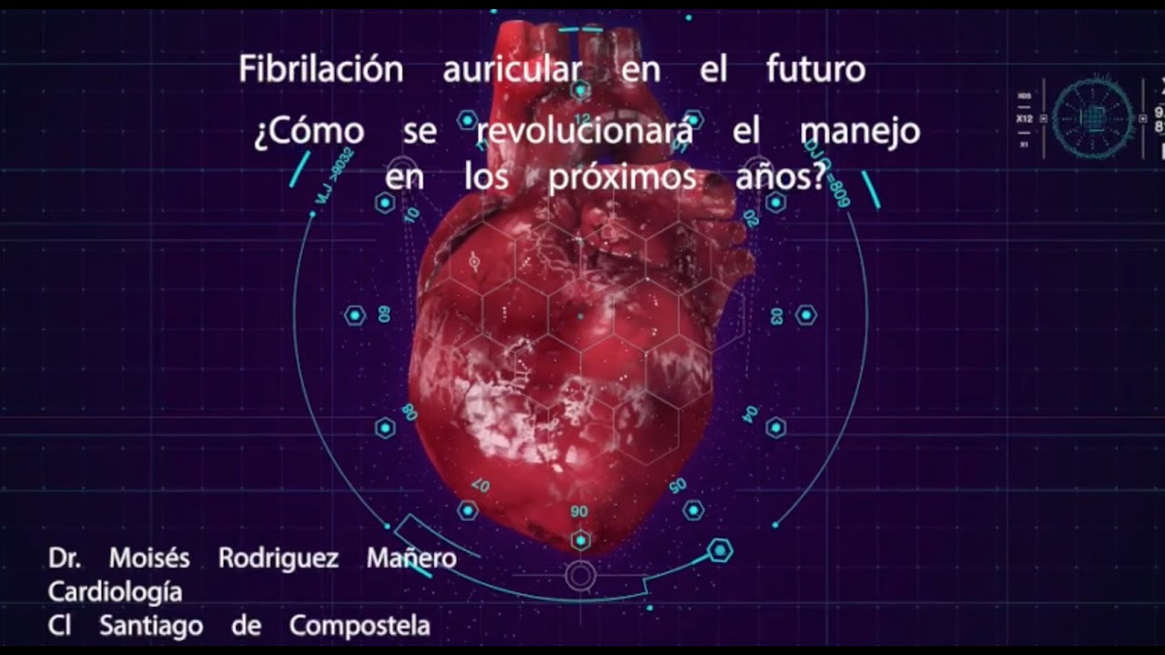 Sesión Clínca: Fibrilación auricular en el futro. ¿Cómo se revolucionará el manejo proximamente?