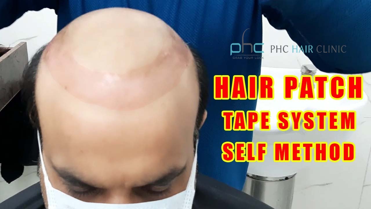 How to do Hair Patch Service | Taping System Self Method Call +91 9899746489