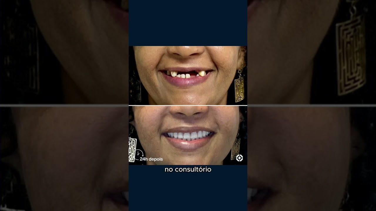 Saiba como surgiu o Borelli System®️! 