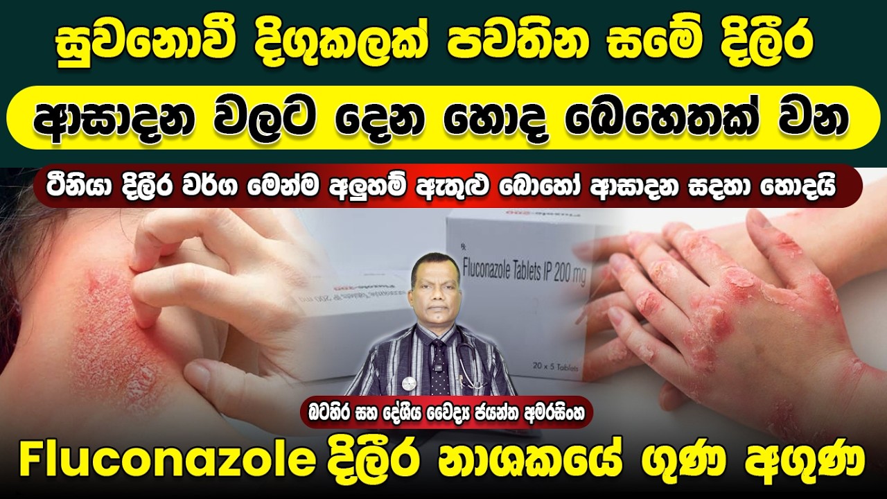සුවනොවී දිගුකලක් පවතින සමේ දිලිර අසාදන වලට ලබාදෙන හොද බෙහෙතක් වන Fluconazole දිලිර නාශකයේ ගුණ අගුණ