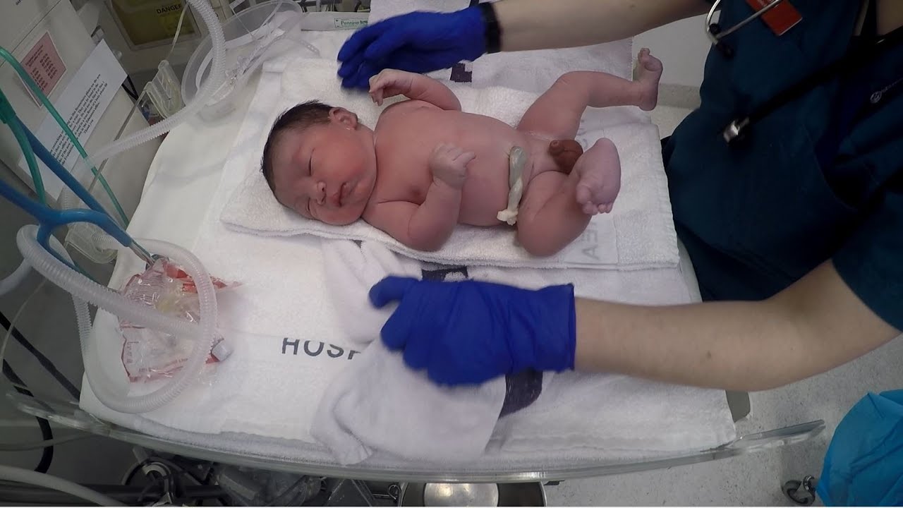 Cute baby born by C-section or Caesarean (HD) - First physical exam (2020)