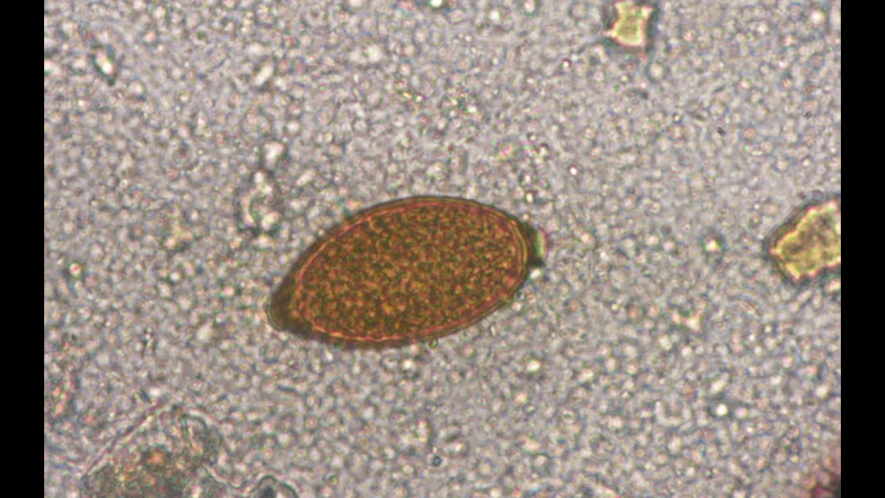 Trichuris vulpis y Toxocara canis. CIAB  www.ciab.es.