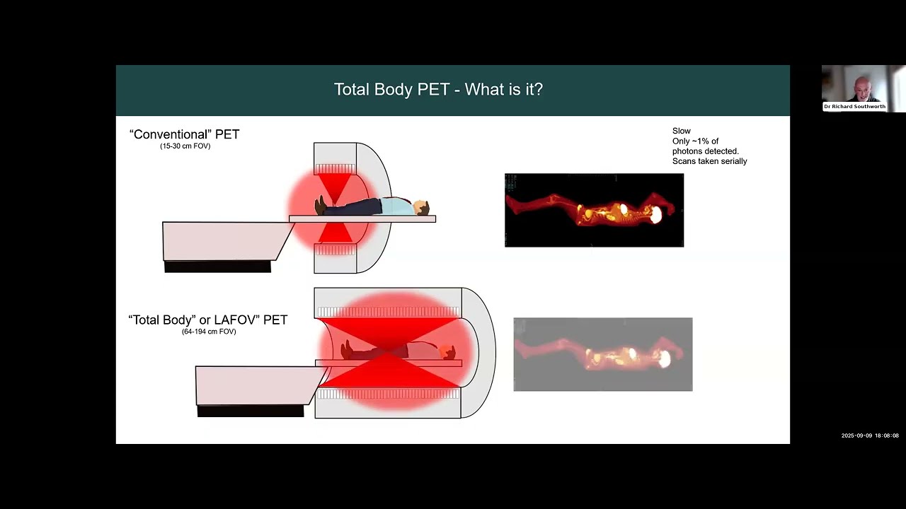 New Opportunities in Cardiac Molecular Imaging | Dr Richard Southworth | BNMS Webinar 9 Sept 2025