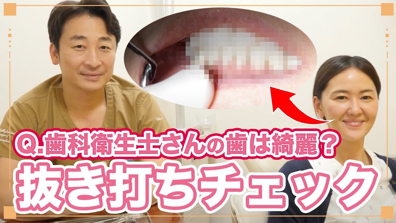 歯科衛生士でも虫歯はある？口内を抜き打ちチェック！