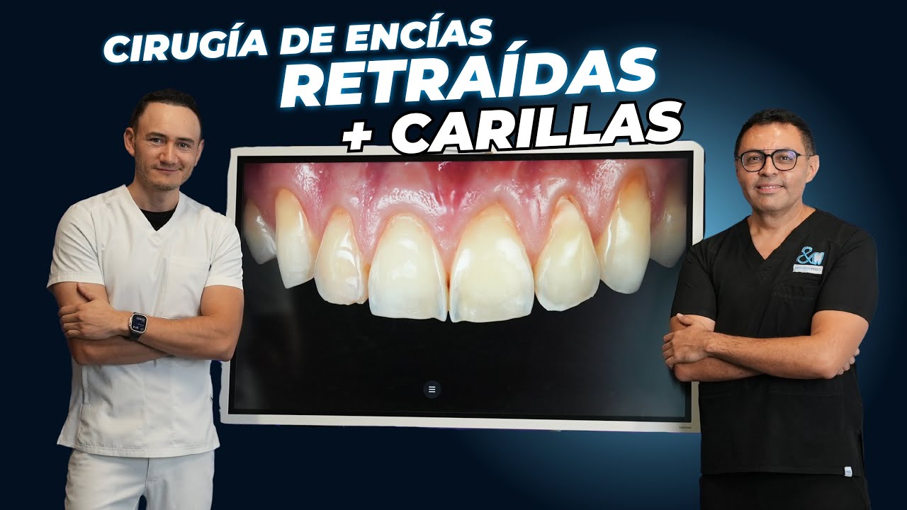 ¿Tienes encías retraídas?¿No te gustan tus dientes? Esta solución puede ser para ti