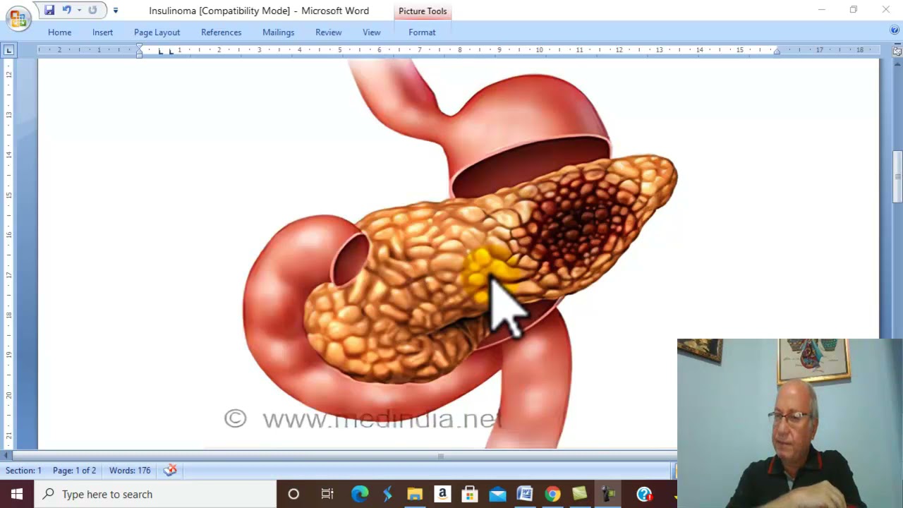 Pancreatic Disorders in Arabic 7 ( Insulinoma) , by Dr. Wahdan