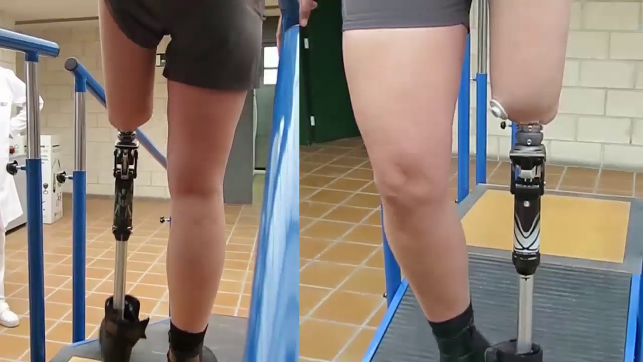 Encaje Integral en Elastómero de Silicona para Prótesis Femoral- OROSUR S.A.