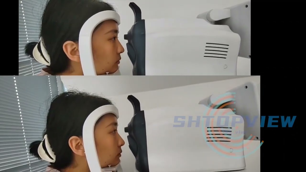 Revolutionary Pachymetry Function Achieves World First in Non-Contact Tonometer Technology