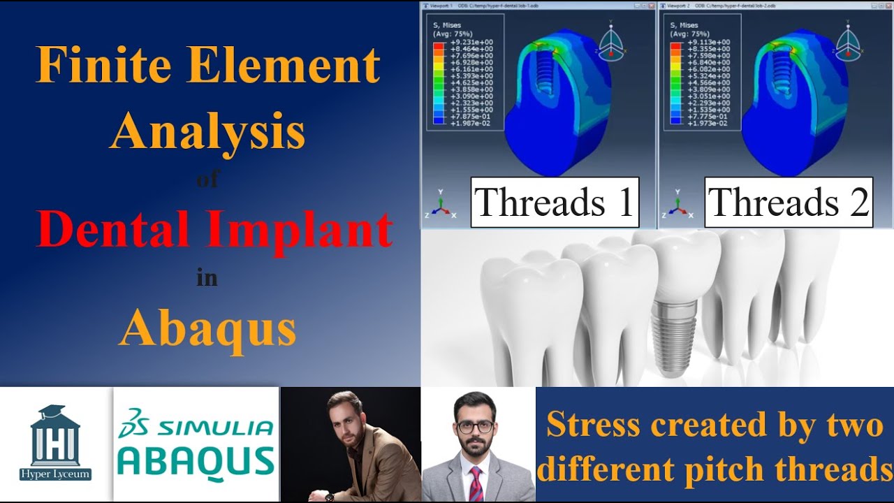 Конечно-элементный анализ дентального имплантата в Abaqus