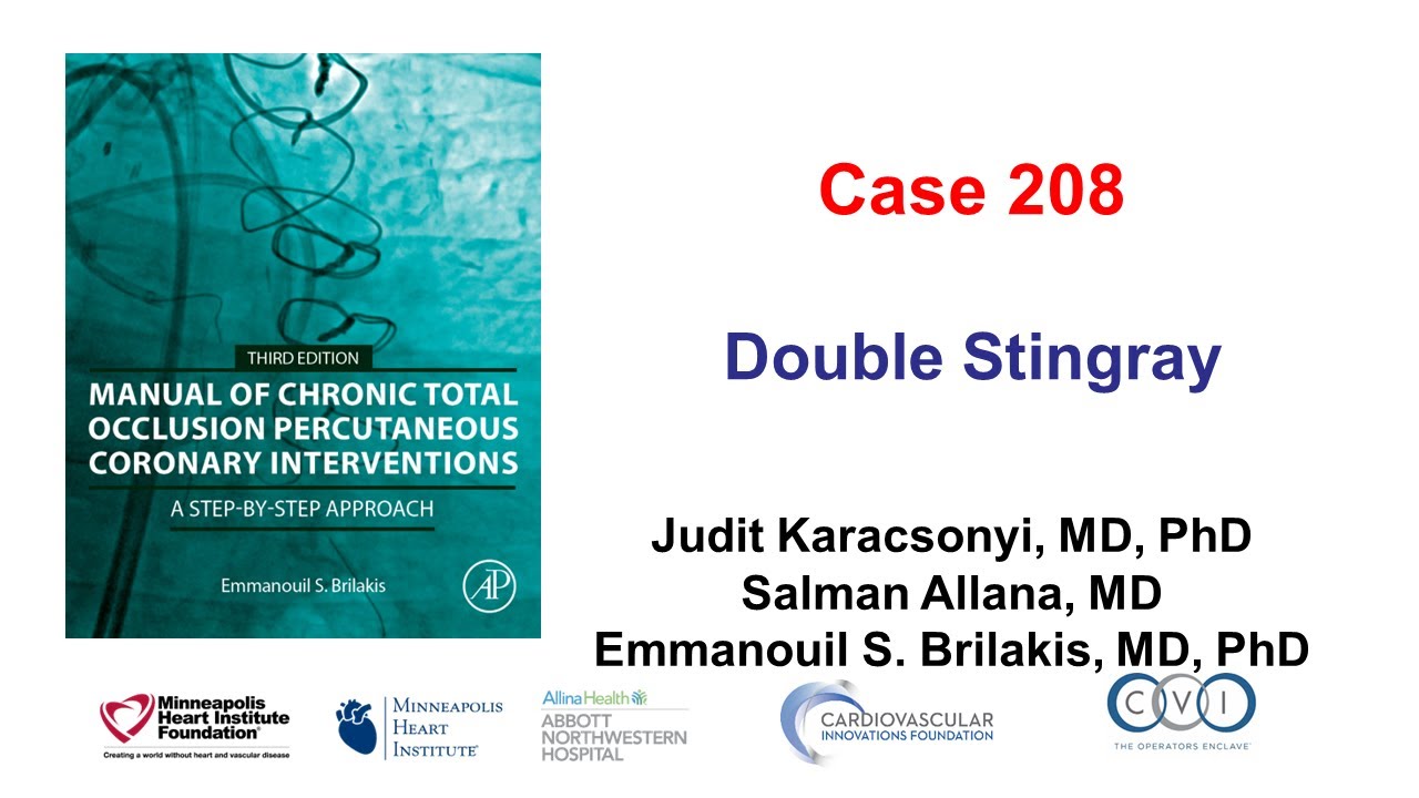 Case 208: Manual of CTO PCI - Double Stingray