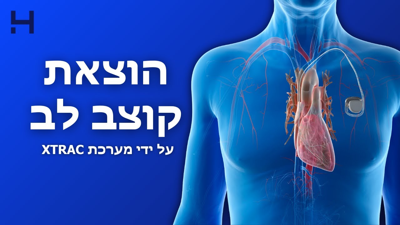 הוצאת קוצב לב ישן | CUT מנתחים | הדסה טי וי