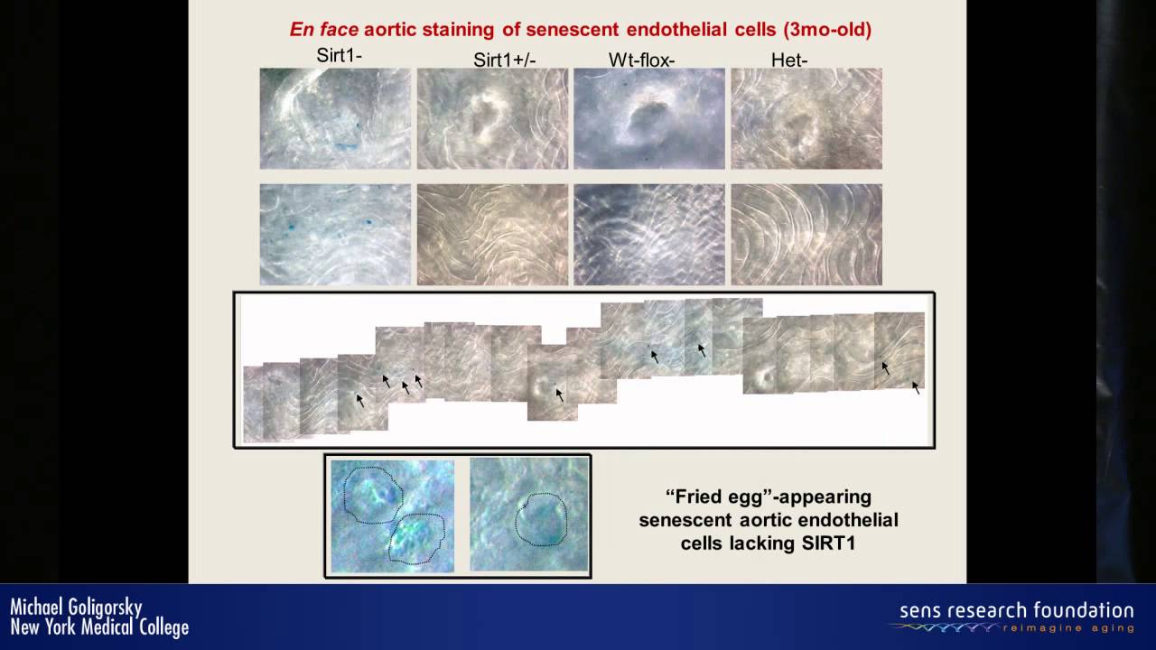 Cardiovascular stressors induce premature senescence of vascular endothelium - Michael Goligorsky