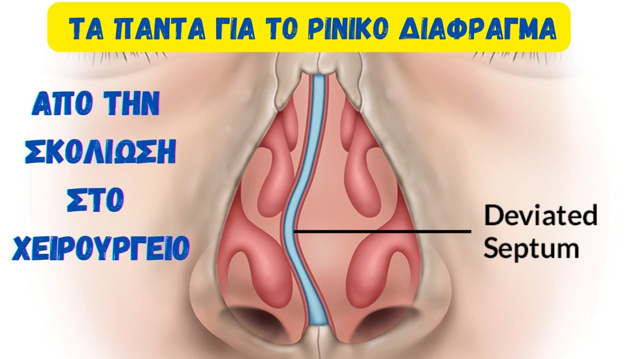 ΧΕΙΡΟΥΡΓΕΙΟ στο ΔΙΑΦΡΑΓΜΑ, όλα όσα πρέπει να γνωρίζετε