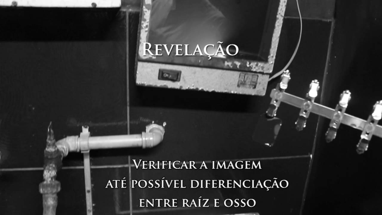 Processamento radiográfico