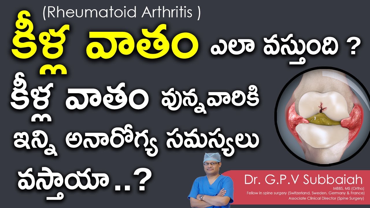 కీళ్ల వాతం వున్నవారికి వచ్చే సమస్యలు I Rheumatoid arthritis I health videos in telugu I Dr Subbaiah