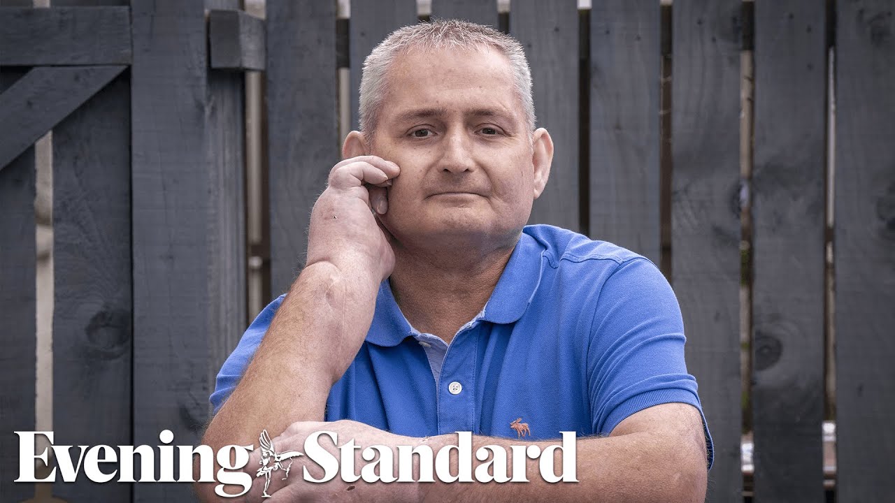 Man undergoes &lsquo;world first &lsquo; double hand transplant