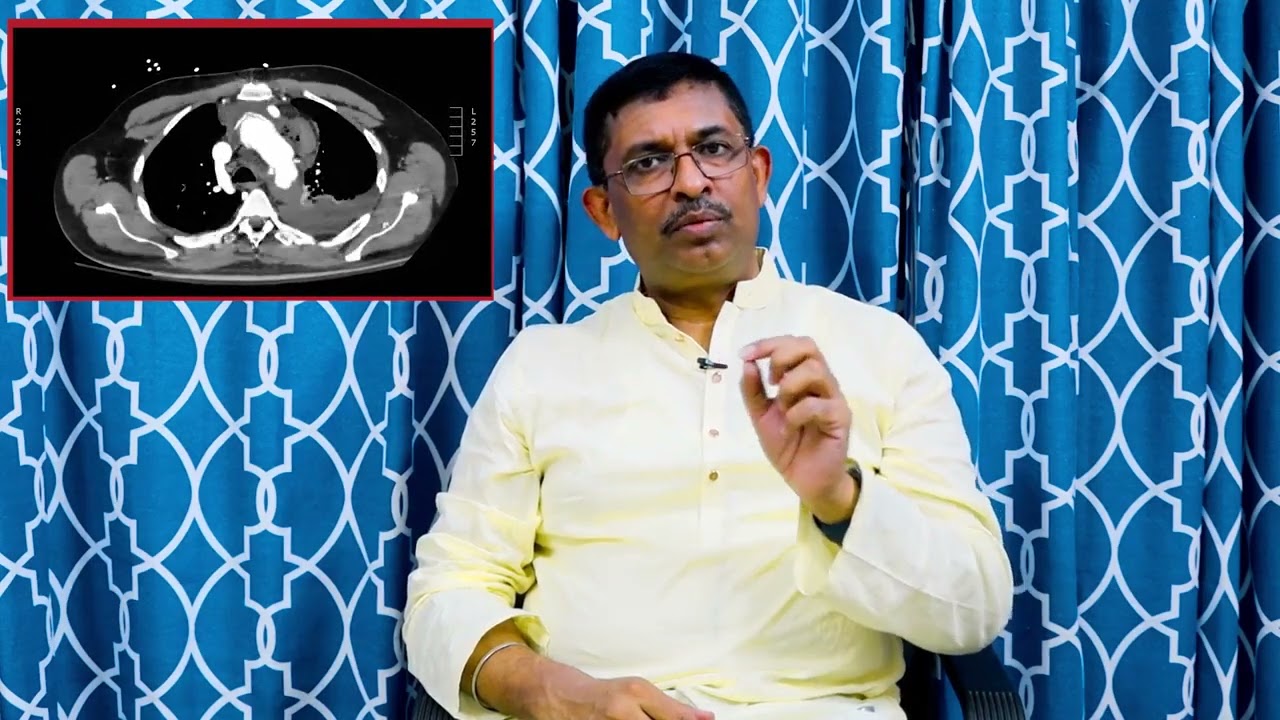 সিটি এনজিওগ্রাম এর মাধ্যমে কিভাবে রক্তনালীর রোগ নির্ণয় করা হয়