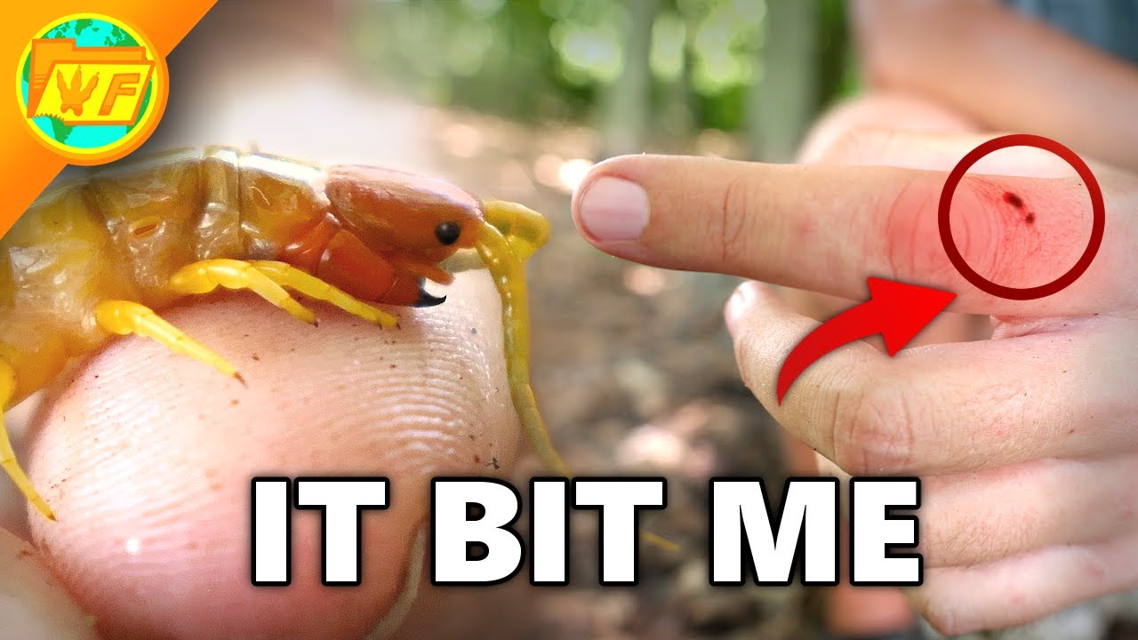BITTEN by a Venomous Centipede!