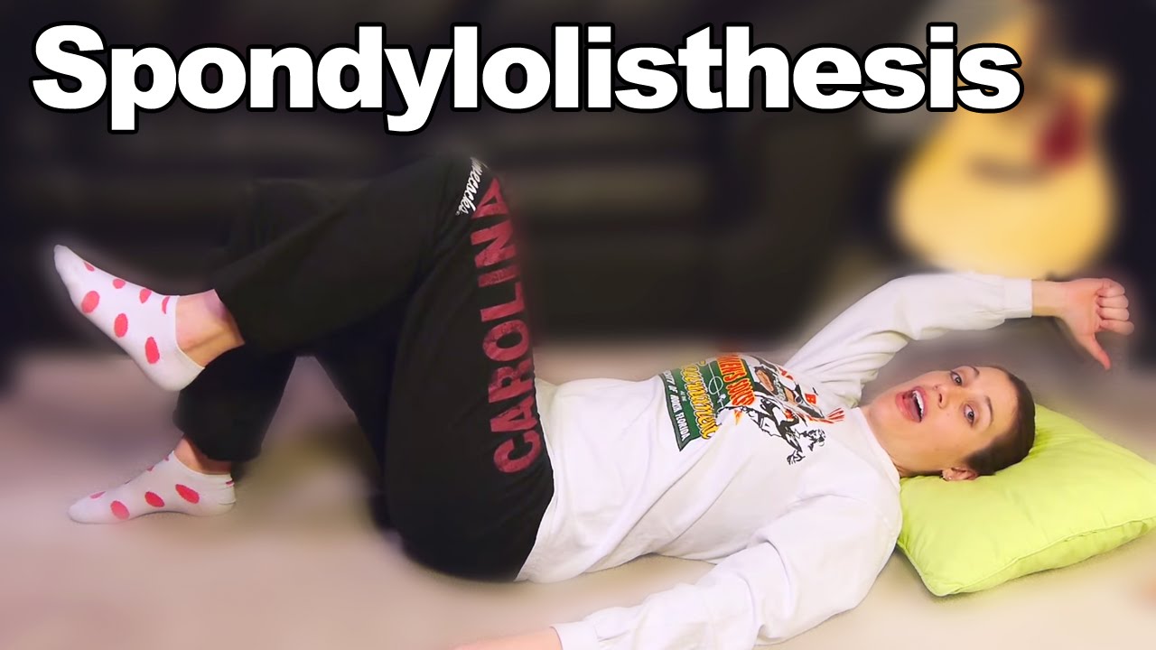 Spondylolisthesis Exercises & Stretches for Back Pain - Ask Doctor Jo