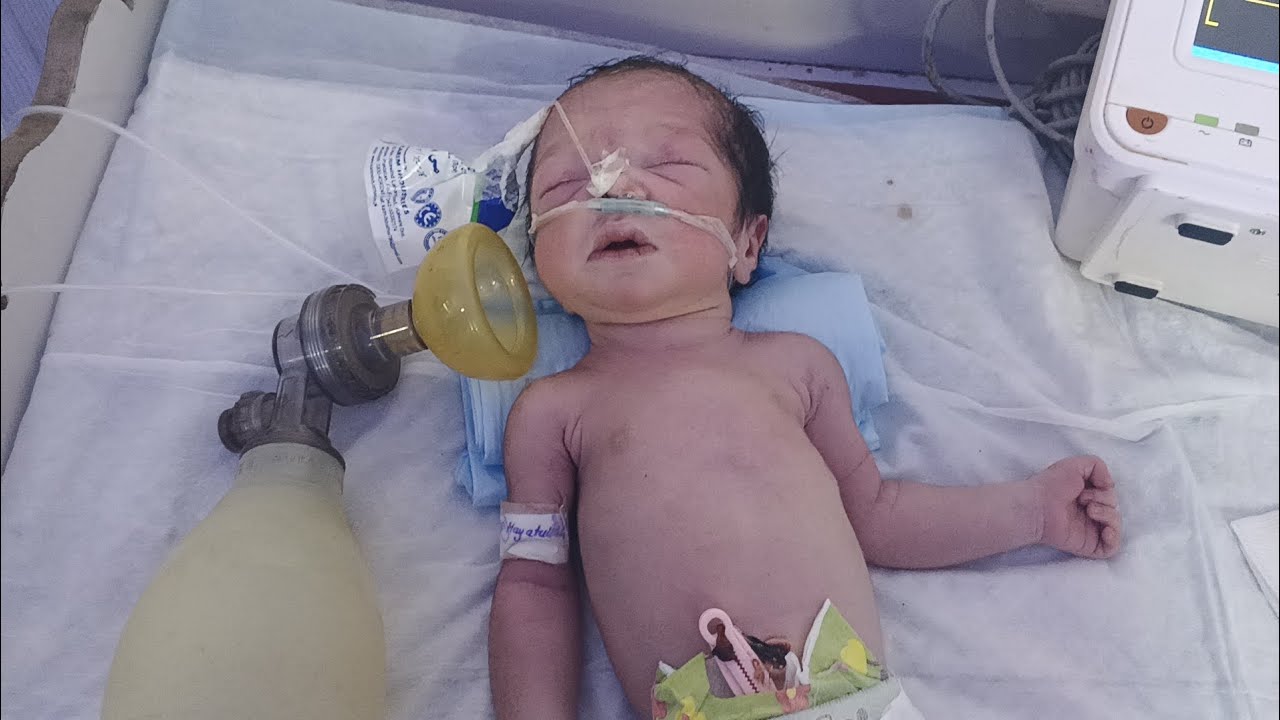 Critical NICU Emergency | Baby Last Movement | CPR, Ambu Bag, Suction & Emergency Drugs