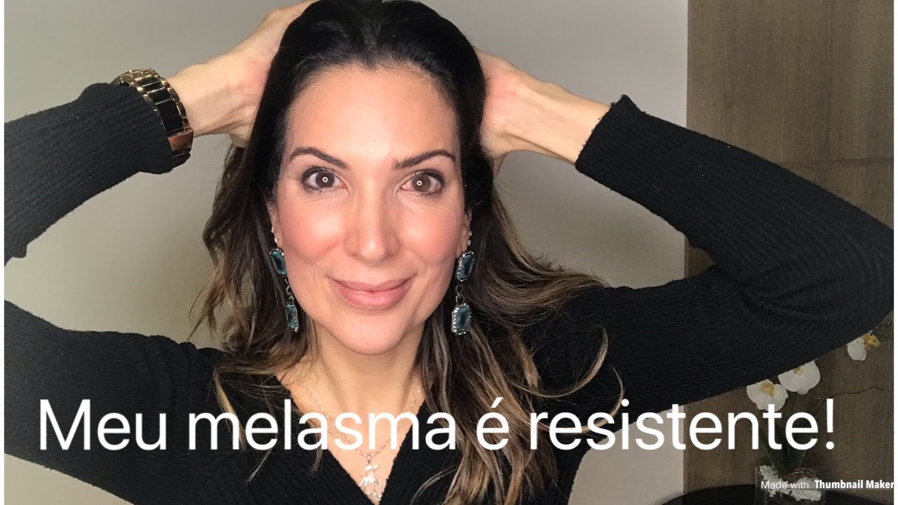 Meu melasma não melhora! Parte 2