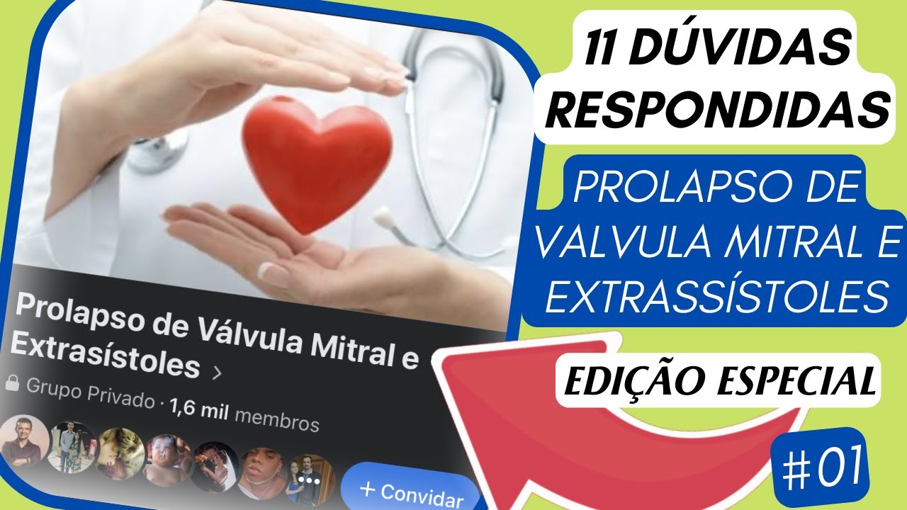 Prolapso de valvula mitral e extrassístole
