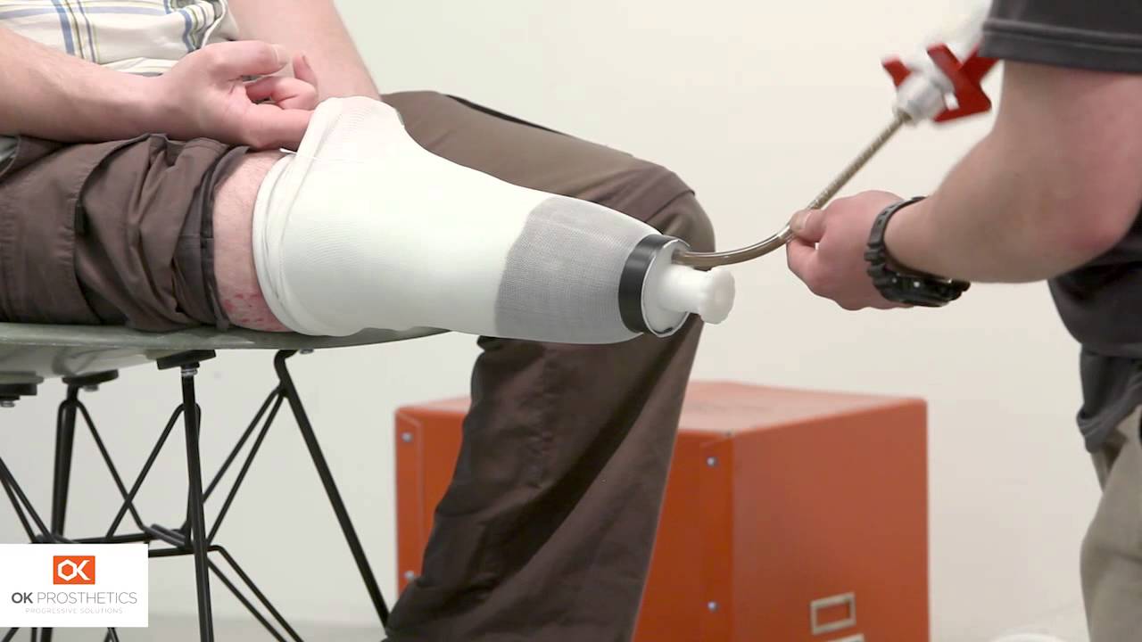 OK Prosthetics - Amputee Assistance