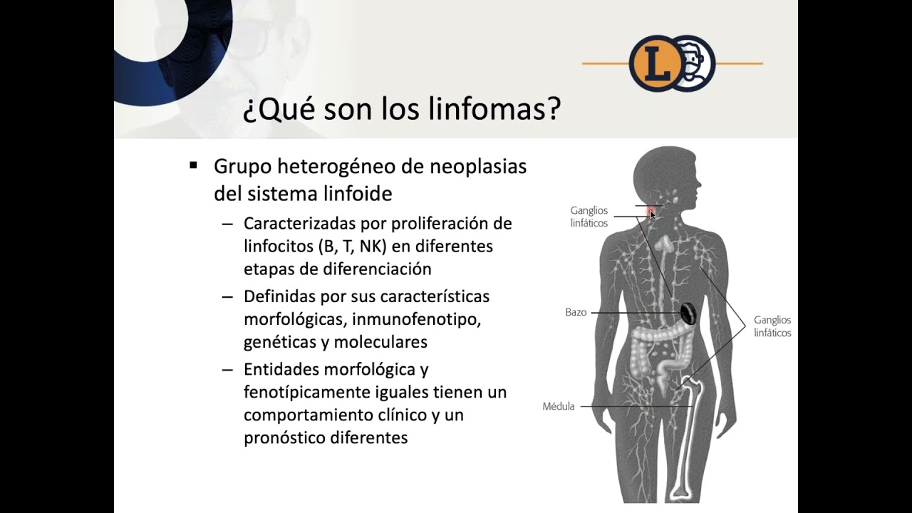 La importancia del diagnóstico temprano en el linfoma: la otra cara de los síntomas inespecíficos