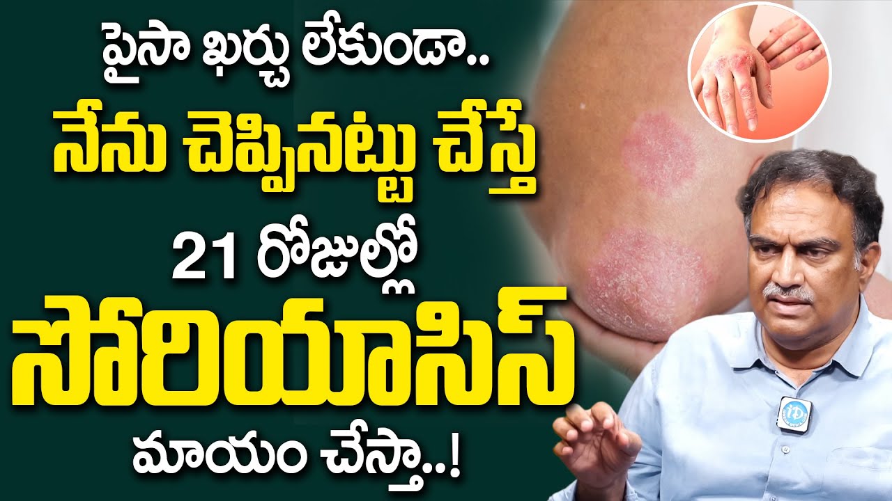 ఇలా చేస్తే సోరియాసిస్ మాయం | Psoriasis Treatment | in Telugu | Dr Veeramachaneni Diet | iDream