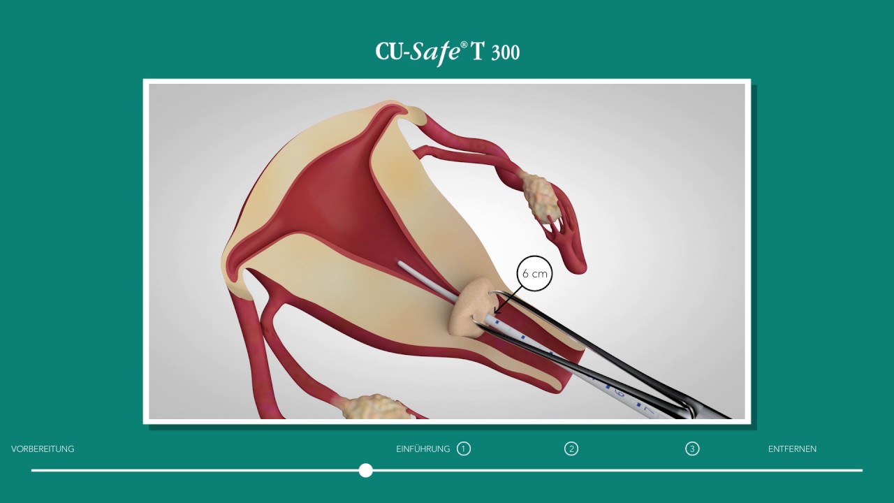 CU-Safe T 300 Einführanleitung