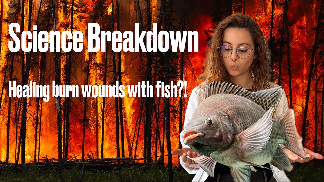 Healing burn wounds with fish? Science breakdown